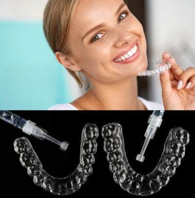Westmoreland Family Dentistry Teeth Whitening